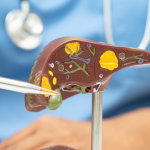 Las hepatitis afectan al hígado. Foto: SSÑ