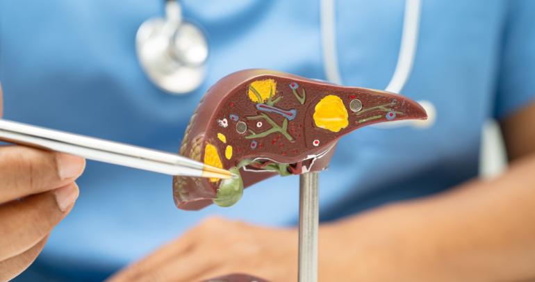 Las hepatitis afectan al hígado. Foto: SSÑ